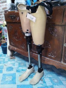 pengrajin kaki palsu indonesia