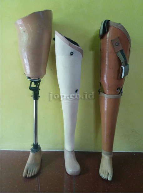 kaki palsu lokal indonesia