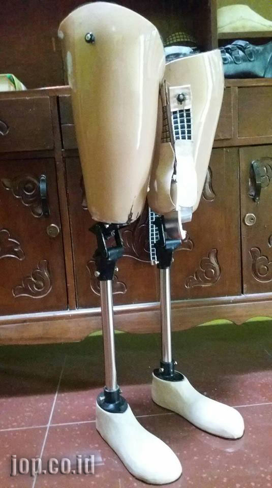 kerangka kaki palsu atas lutut