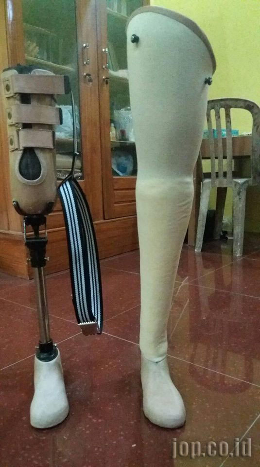 kaki palsu kerangka endoskeletal